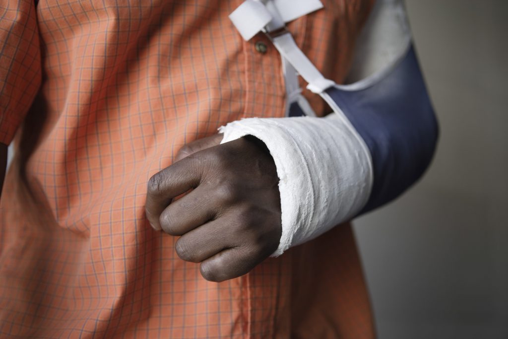 An injured african american man with an arm support
